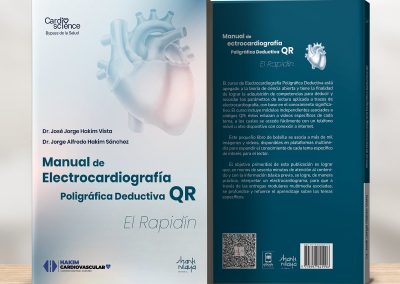 Manual de Electrocardiografía Poligráfica Deductiva QR El Rapidín