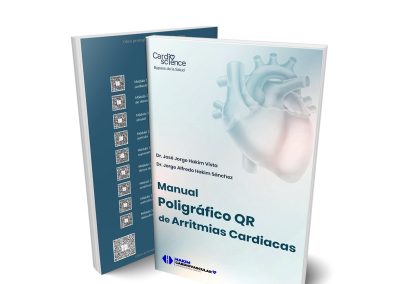 Manual poligráfico QR de arritminas cardiacas